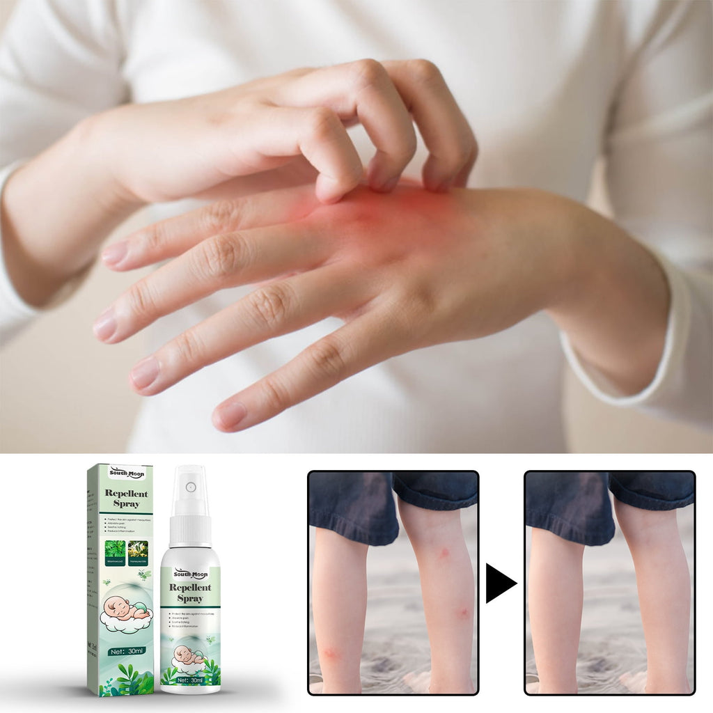 2 Pack Kid Safe Anti-Itch and Anti-Sting Spray for Mosquito Bite Relief, Bug Bite Itch Relief, Bee Stings, Hives and More